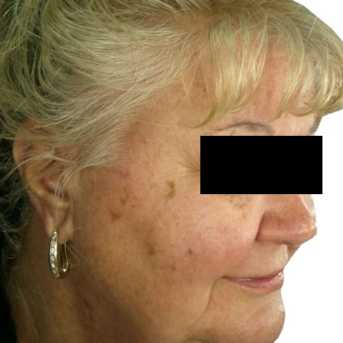 venus_versa_1_before