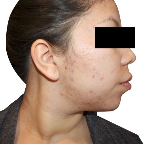 venus_versa_2_before